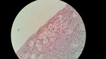 MISSING THUMBNAIL